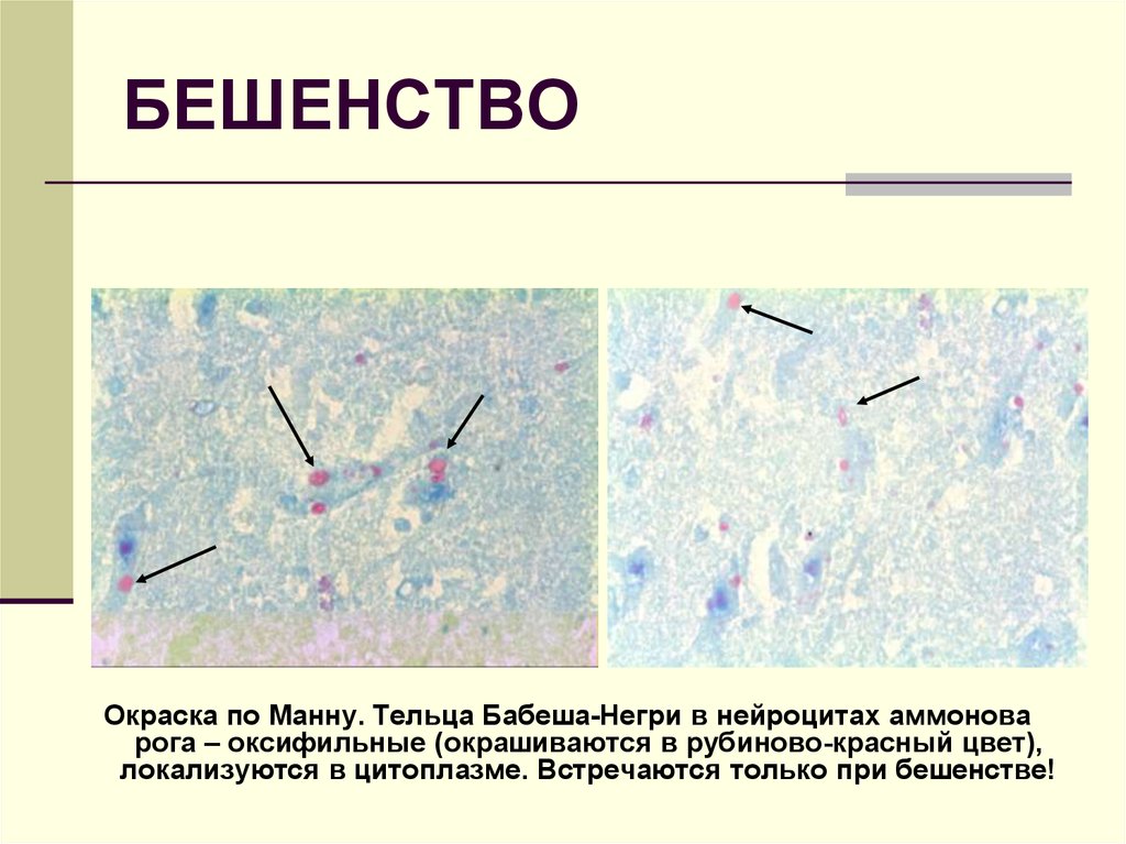 Включения цитоплазмы имеющие собственную окраску. Тельца Бабеша негри окраска по манну. Тельца негри микробиология. Тельца Бабеша негри микроскопия. Вирус бешенства тельца Бабеша негри.