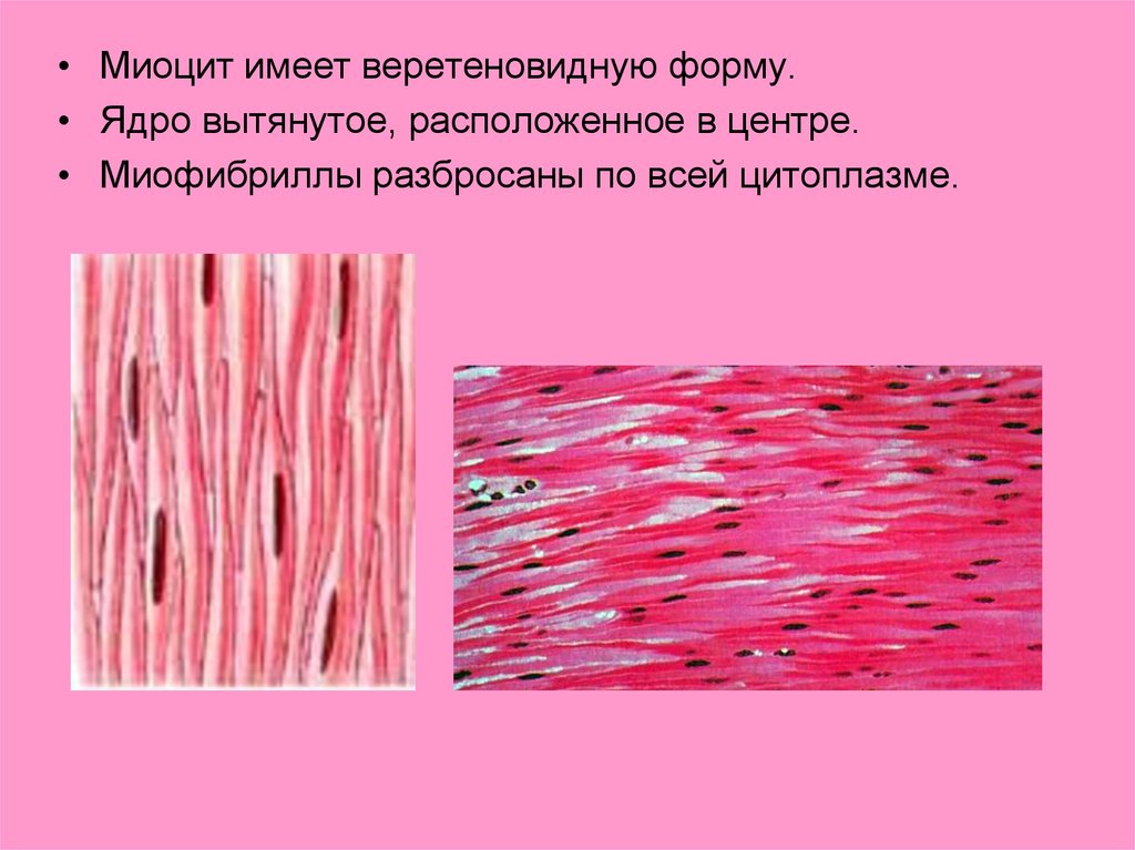 Веретеновидные клетки какая
