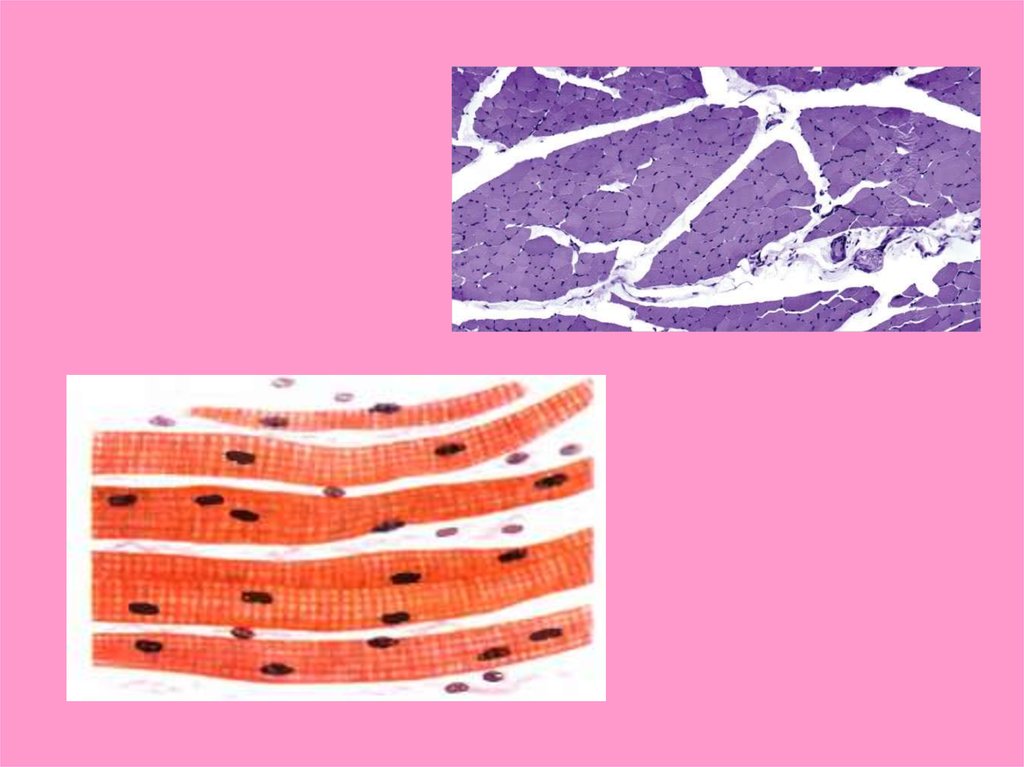 Отличие гладкой и поперечно полосатой ткани. Поперечно-полосатая Скелетная мышечная ткань. Атрофия мышечной ткани. Пигмент мышечной ткани. Мышечная ткань презентация.