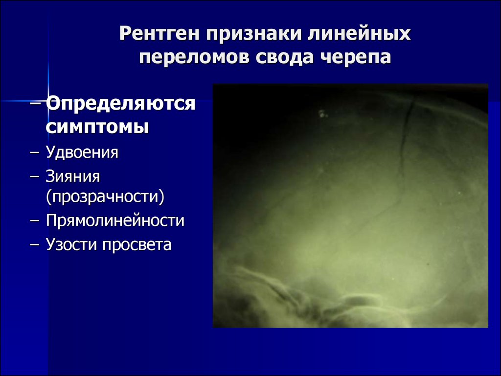 Рентгенологические признаки