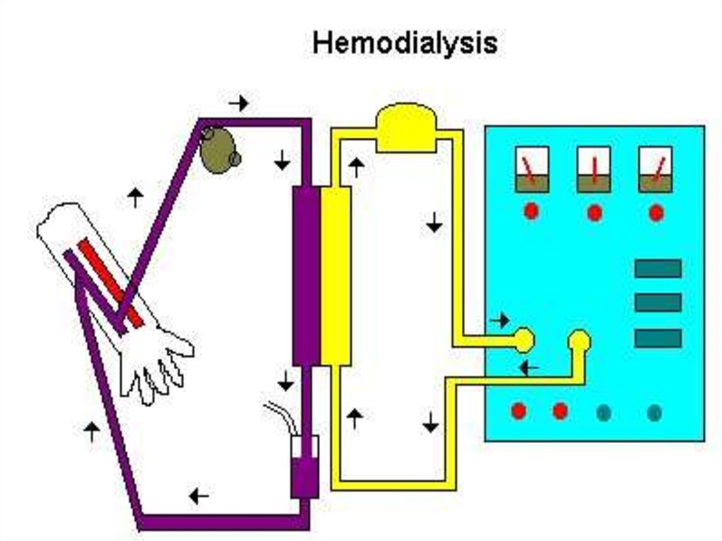 Диализ схема проведения