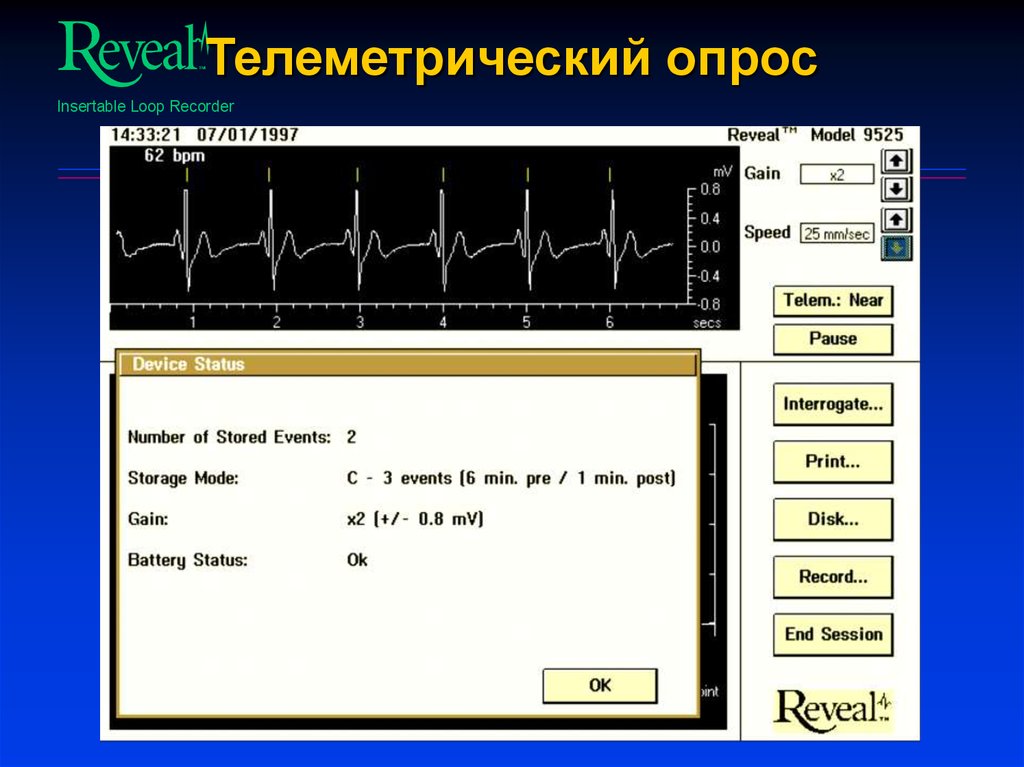 Телеметрический опрос