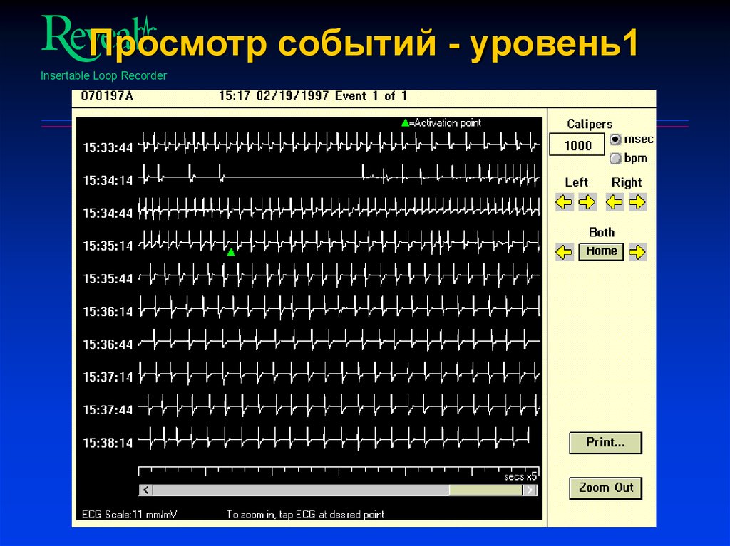 Просмотр событий - уровень1