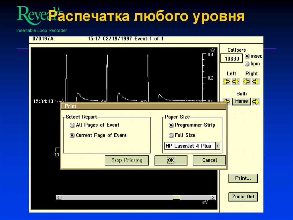 Распечатка любого уровня