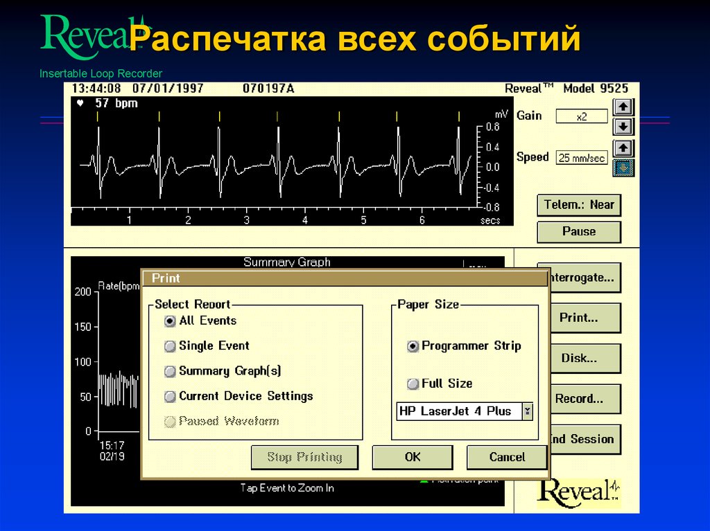 Распечатка всех событий