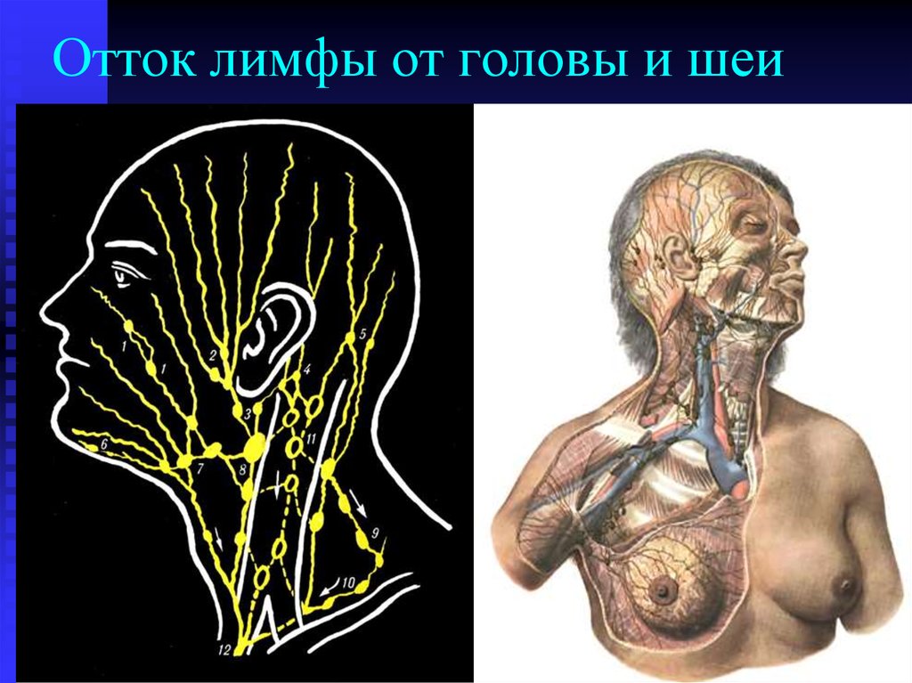 Нарушение лимфооттока. Лимфатическая система лица схема движения лимфы. Лимфатическая система человека схема движения лимфы на лице. Лимфатическая система головы человека. Лимфатисистема головы и шеи.