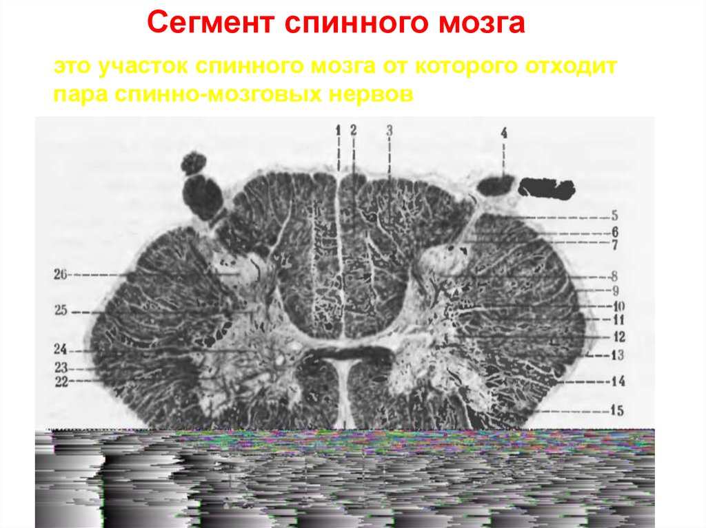 Оболочки спинного мозга схема. Цистерны спинного мозга. Анатомия спинного мозга собаки.