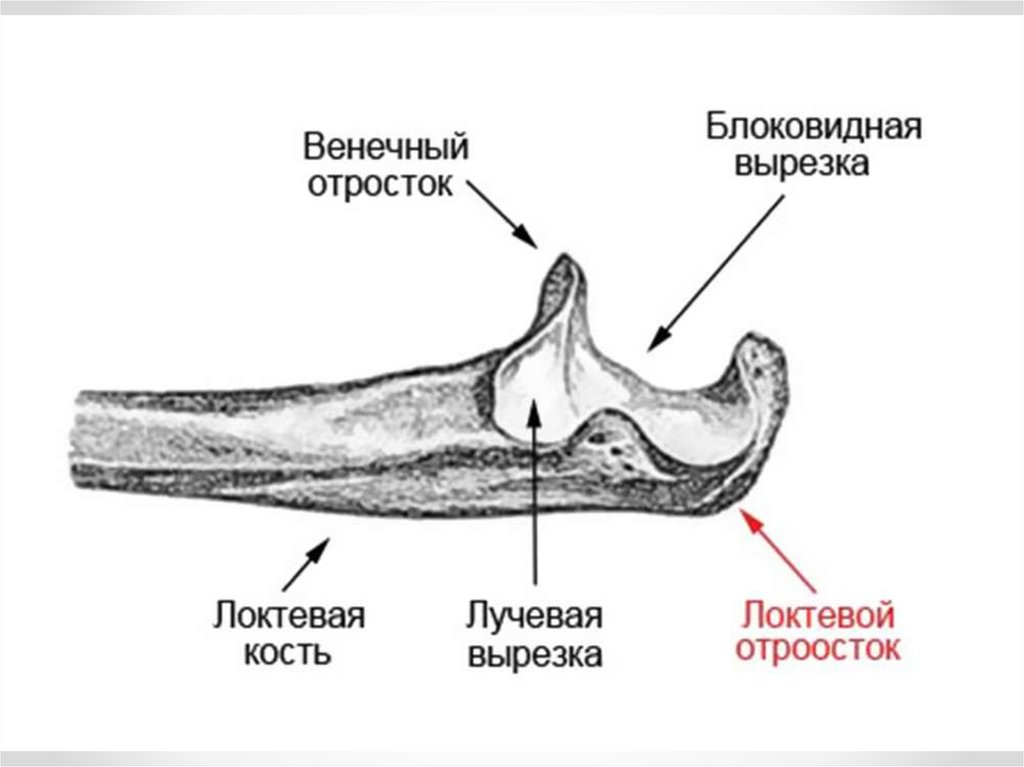 Локтевой отросток локтевой кости. Перелом венечного отростка локтевая кость. Перелом венечного отростка локтевой кости механизм. Венечный отросток локтевого сустава. Краевой перелом венечного отростка локтевой кости.