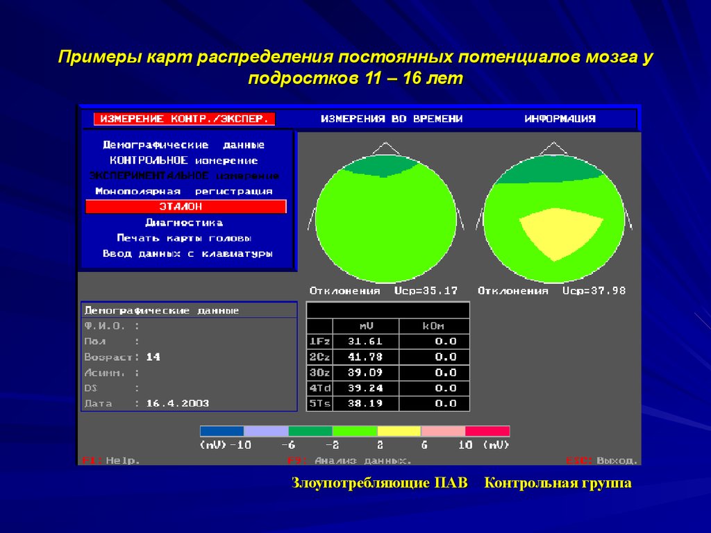 Постоянное распределение. Нейроэнергокартограф. Примеры непрерывных распределений. Непрерывное распределение потенциалов. Постоянные потенциалы мозга.