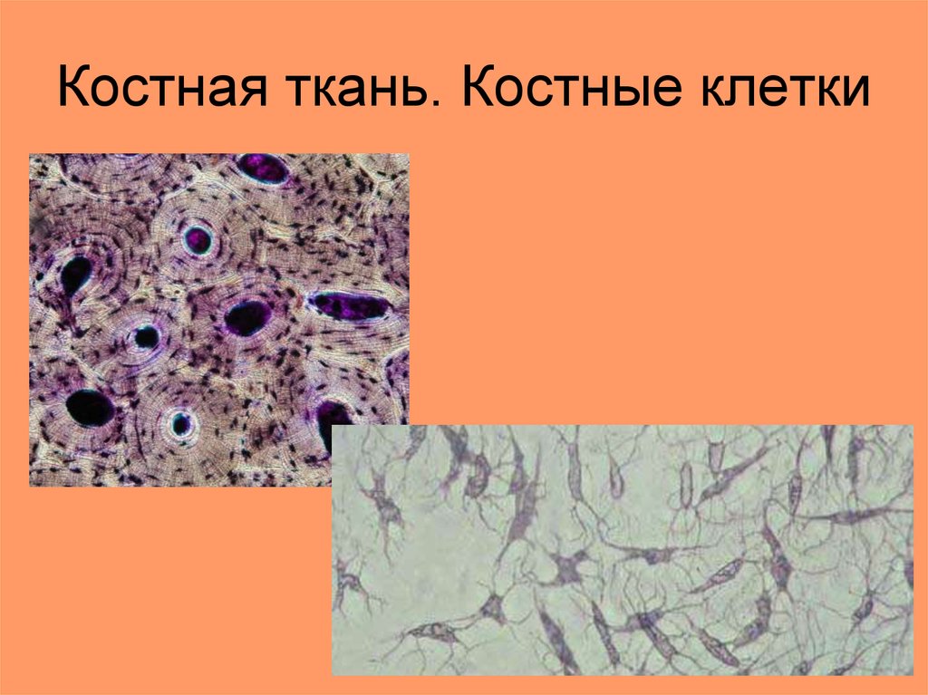 Соединительная ткань костей