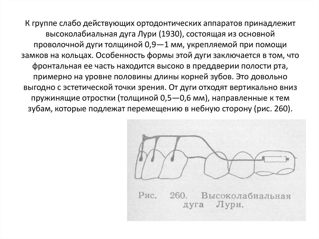 Презентация ортодонтические дуги