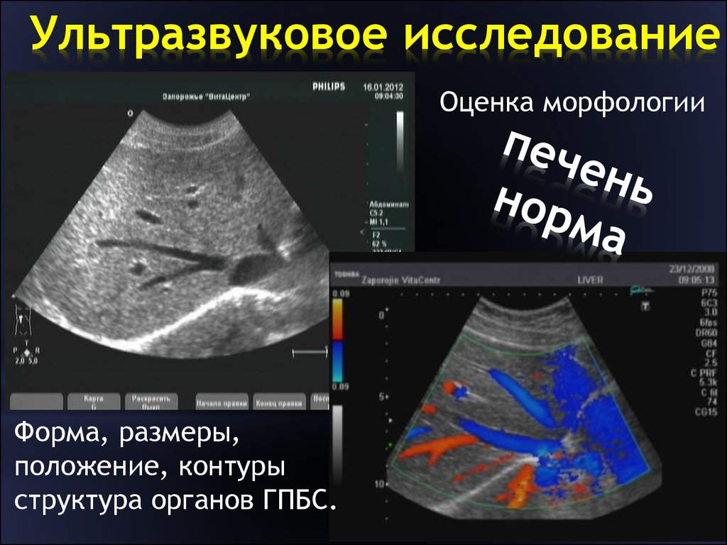 Ультразвуковое исследование в таблицах и схемах