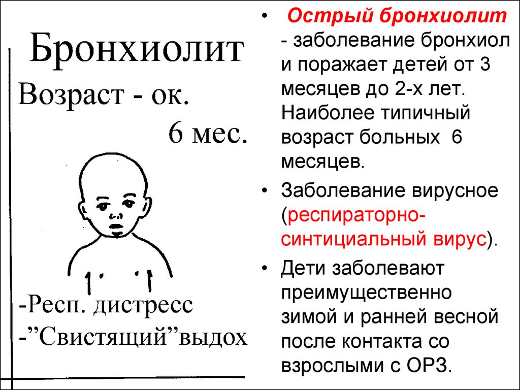 Болезни на месяц. Бронхиолы возрастные особенности. Бронхиолит в 3 месяца. Бронхиолит у грудничка 2 месяца. Состояние ребенка в 7 месяцев заболевания.