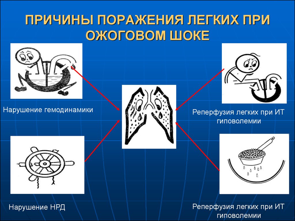 Какая причина поражения. Причины поражения легких.