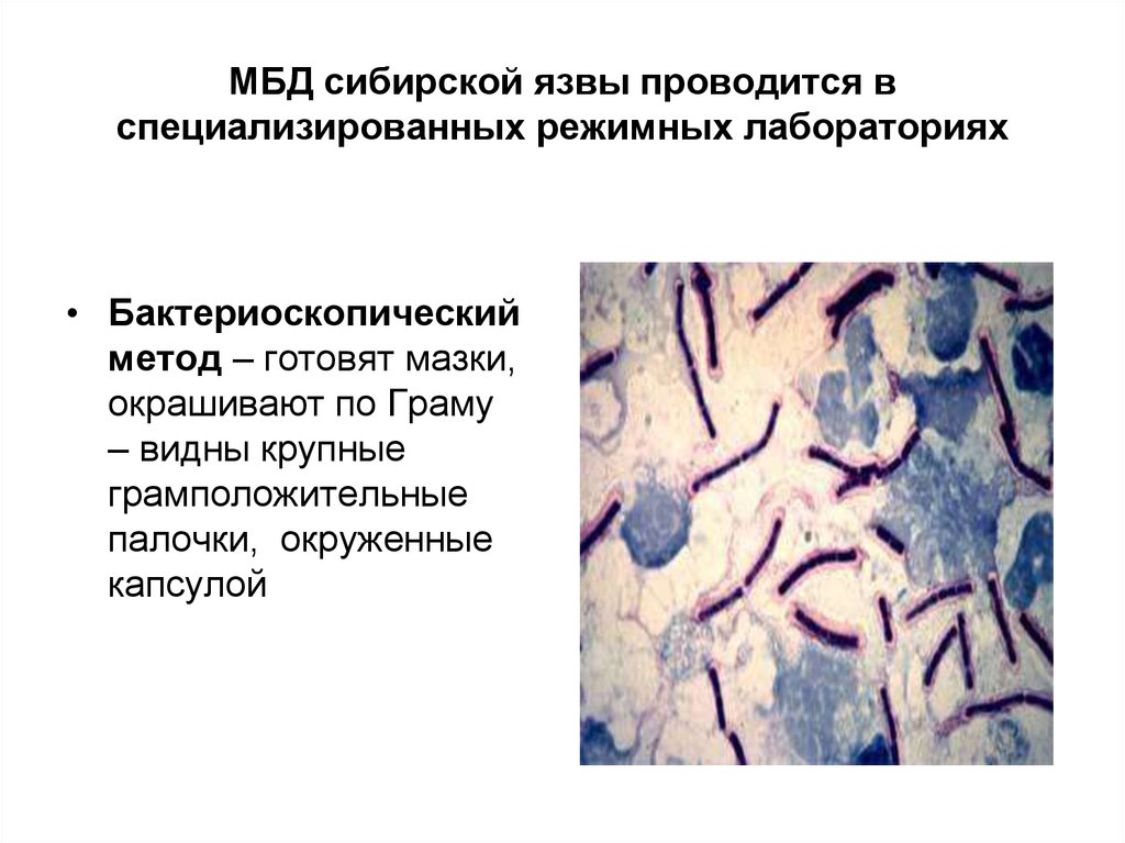 Диагноз сибирская язва. Бактериоскопический метод сибирской язвы. Методы диагностики сибирской язвы микробиология. Схема лабораторной диагностики сибирской язвы. Бактериоскопический метод выявления сибирской язвы.