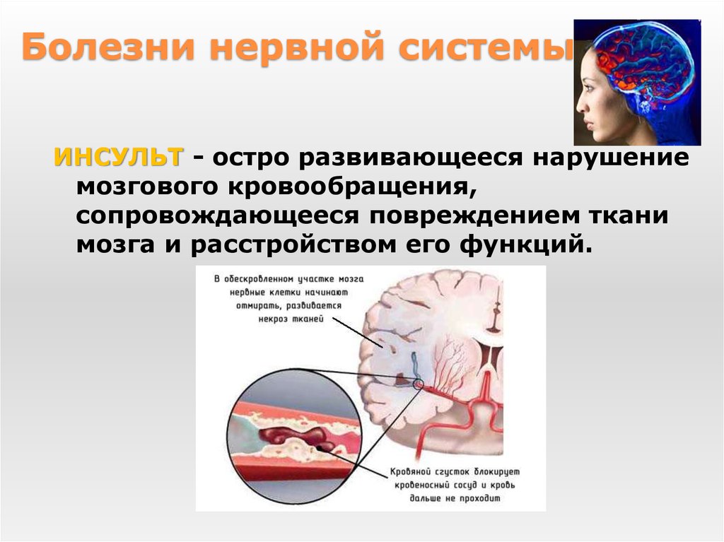 Заболевания нервной системы презентация