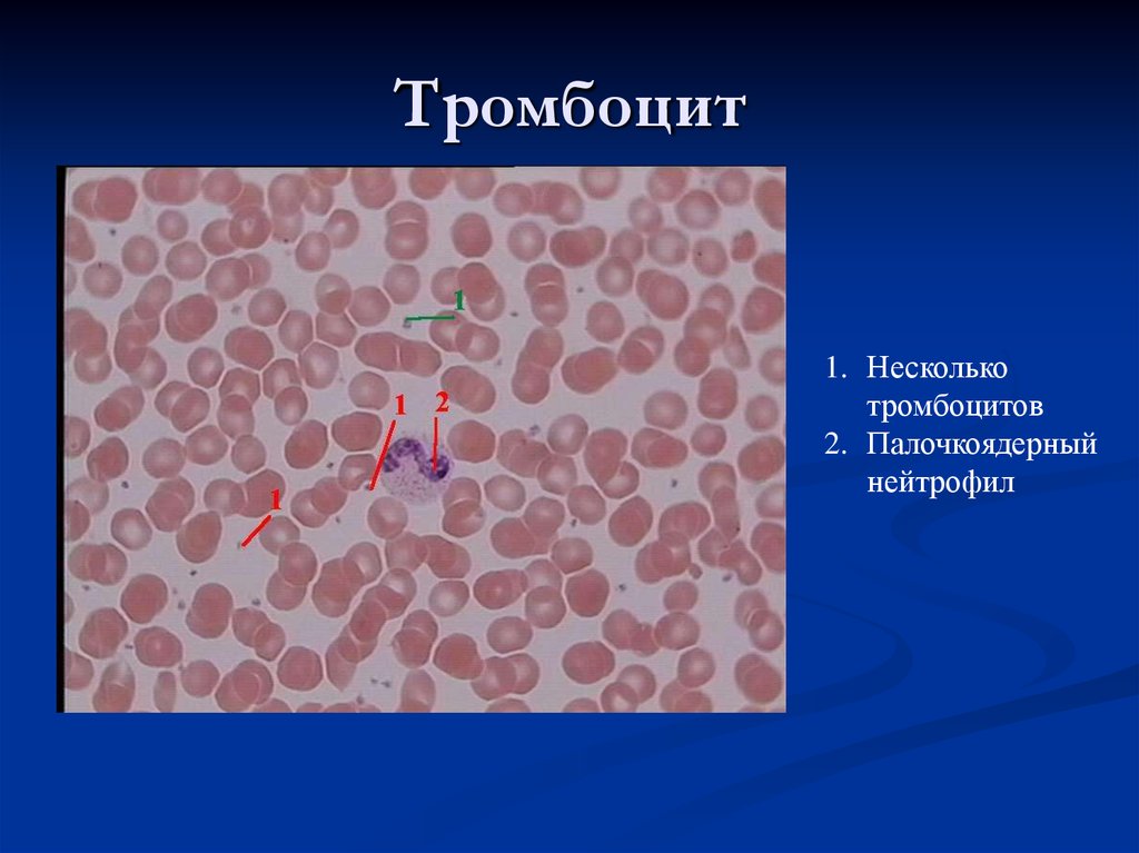 Тромбоциты. Тромбоциты гистология. Тромбоциты микропрепарат. Тромбоциты препарат. Тромбоциты в крови гистология.