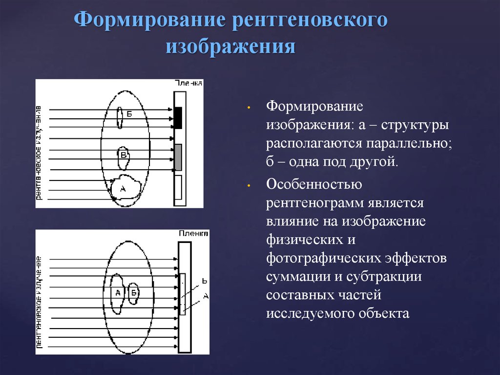 Принципы получения рентгеновского изображения