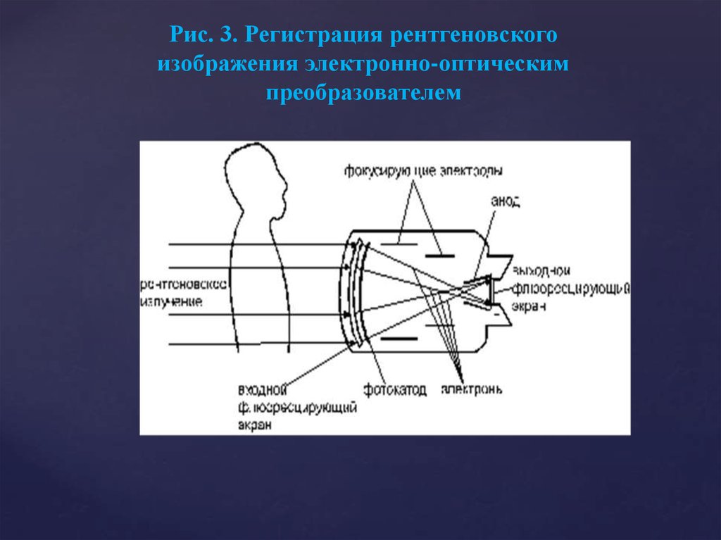 Сущность процесса фиксирования рентгеновского изображения заключается в