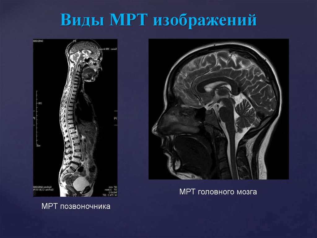 Мрт изображения. Мрт виды. Метод магнитно-резонансной томографии. Виды изображений мрт. Виды томографов для мрт.