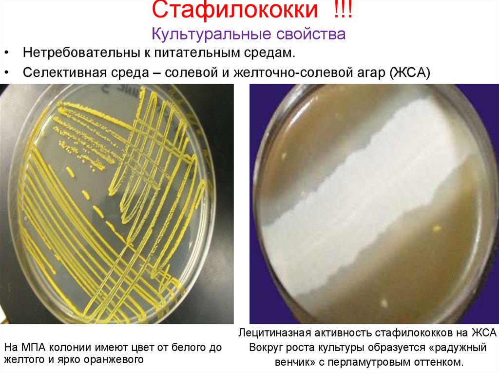 Staphylococcus aureus среда. Рост стафилококков на ЖСА. Радужный венчик стафилококка на ЖСА. ЖСА питательная среда. Желточно солевой агар микробиология.