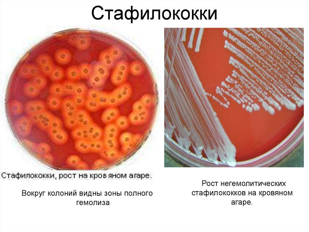 Staphylococcus aureus среда. Рост стафилококка на кровяном агаре. На кровяном агаре колонии стафилококков кровяном. Гемолитический стафилококк.