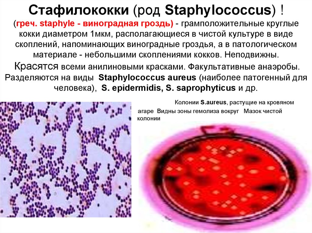 Staphylococcus aureus 4. Грамположительные кокки микробиология. Грамположительные кокки в виде гроздьев винограда. Виноградная гроздь грамположительные кокки стафилококки. Грамположительные кокки убивка.