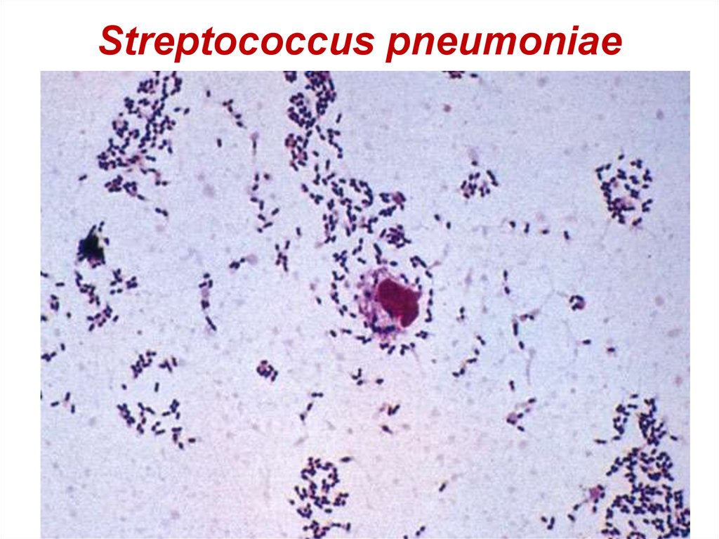 Streptococcus pneumoniae. Пневмококк микроскопия. Стрептококк пневмония микроскопия. Стрептококковая пневмония микроскопия. Стрептококк пневмония морфология.