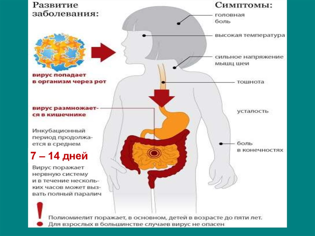 Диагностика полиомиелита. Патогенез полиомиелита микробиология. Полиомиелит этиология патогенез. Механизм передачи возбудителя полиомиелита. Вирус полиомиелита поражает нервную систему.