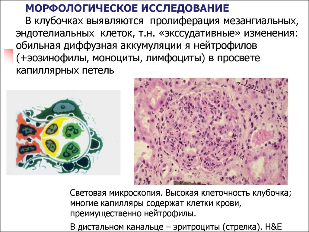 Пролиферация клеток это. Пролиферация клеток крови. Разрастание эндотелиальных клеток. Кровь световая микроскопия. Пролиферация микроскопия.