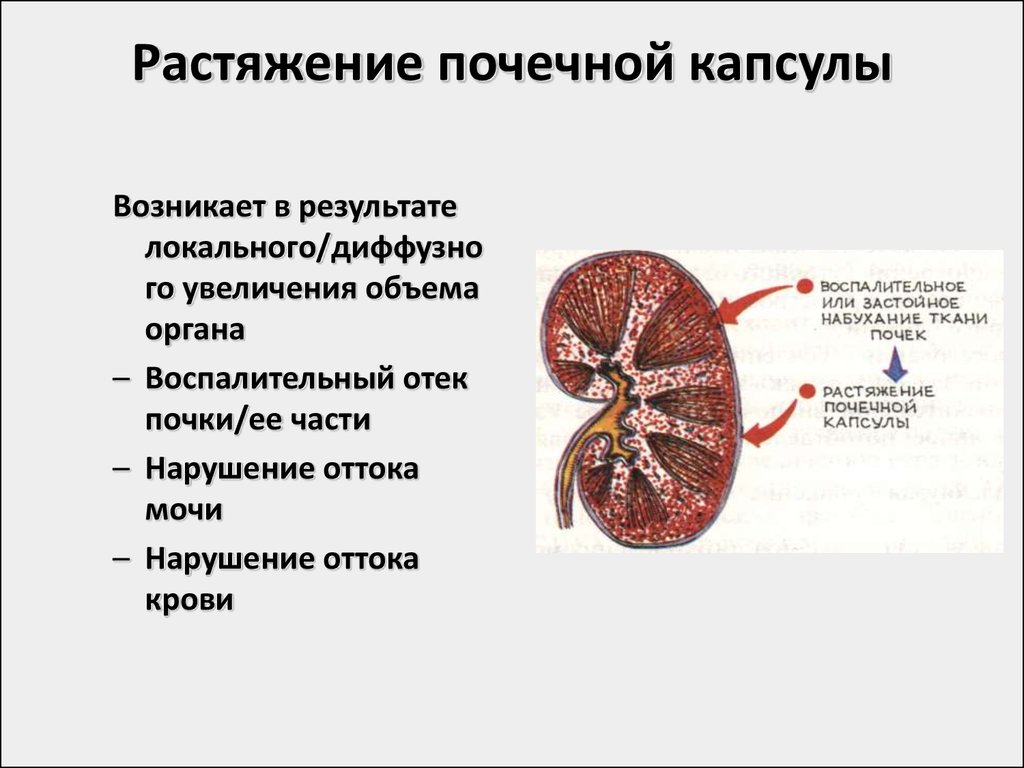 Рисунок почечной капсулы