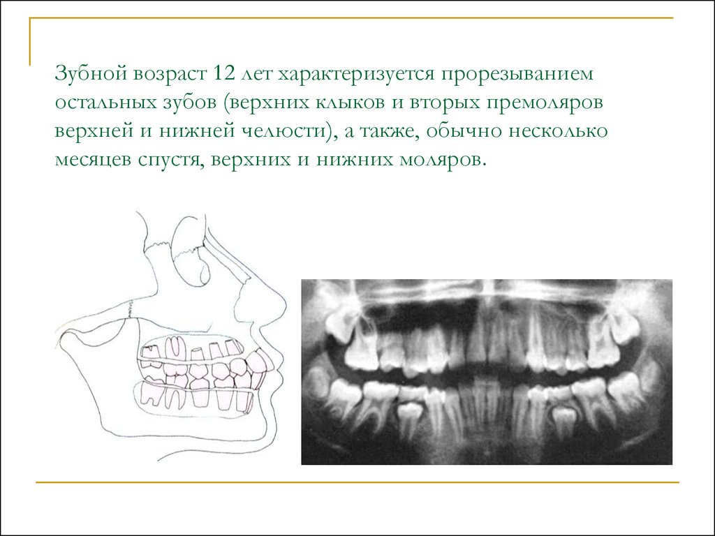 Основы клинической гнатологии биомеханика зубочелюстно лицевой системы презентация