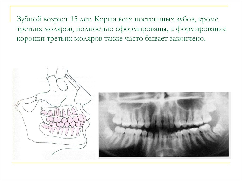 Зубной возраст. Оценка зубного возраста. Зубной Возраст это определение. Зубной Возраст как определить.