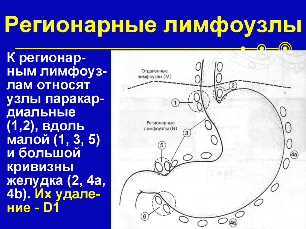 Регионарные лимфатические узлы