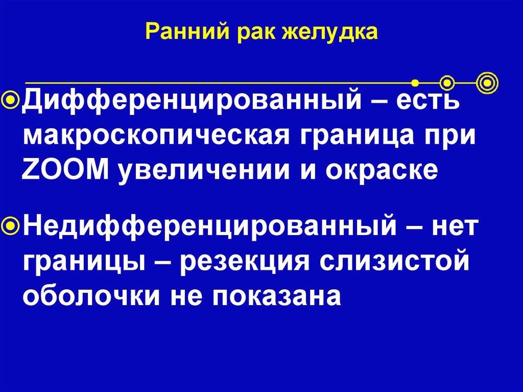 Ранний рак желудка