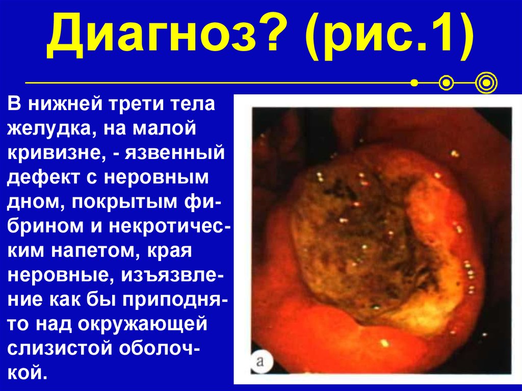 Диагноз? (рис.1)