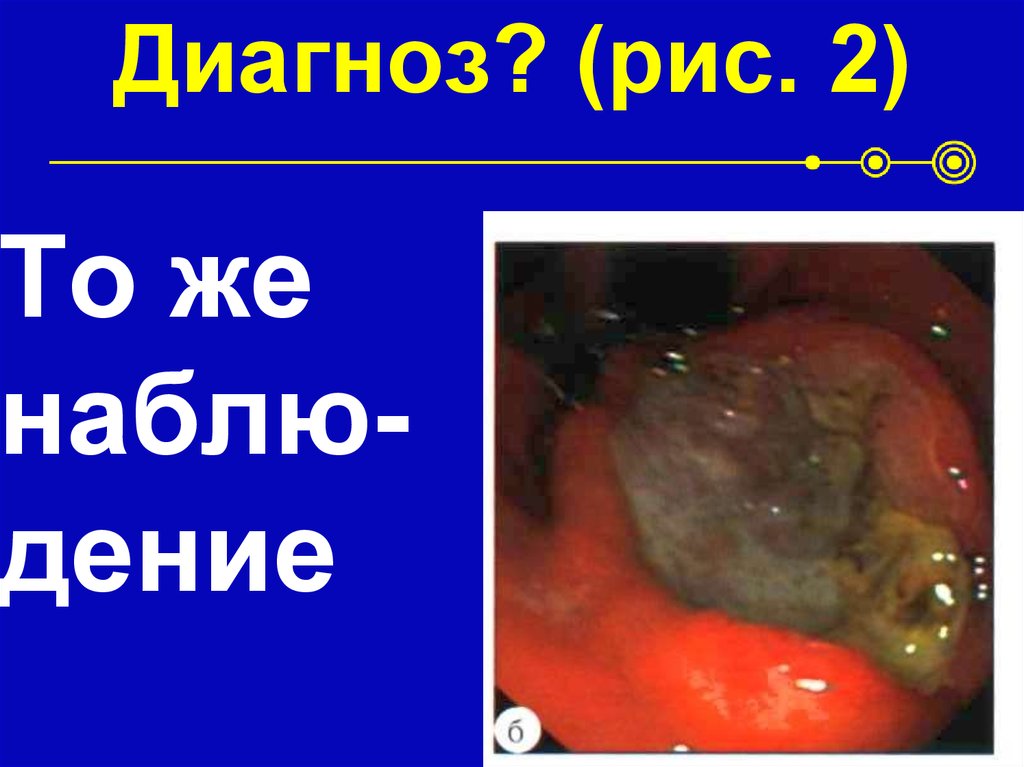 Диагноз? (рис. 2)