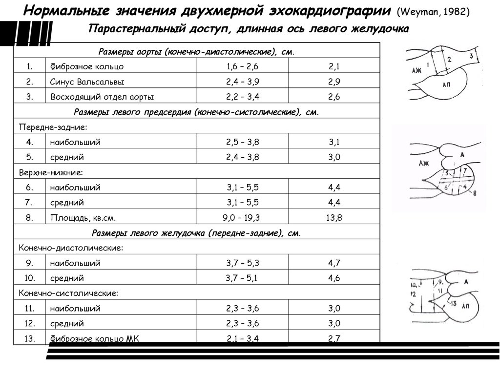 Расшифровка эхокардиографии норма