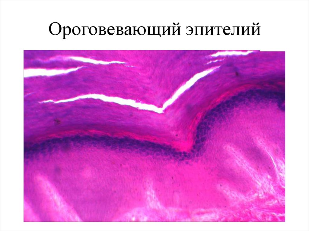 Многослойный ороговевающий эпителий. Ороговевающий эпителий. Ороговевающий покровный эпителий. Многослойный плоский ороговевающий эпителий полости рта. Многослойный плоский ороговевающий эпителий локализация.