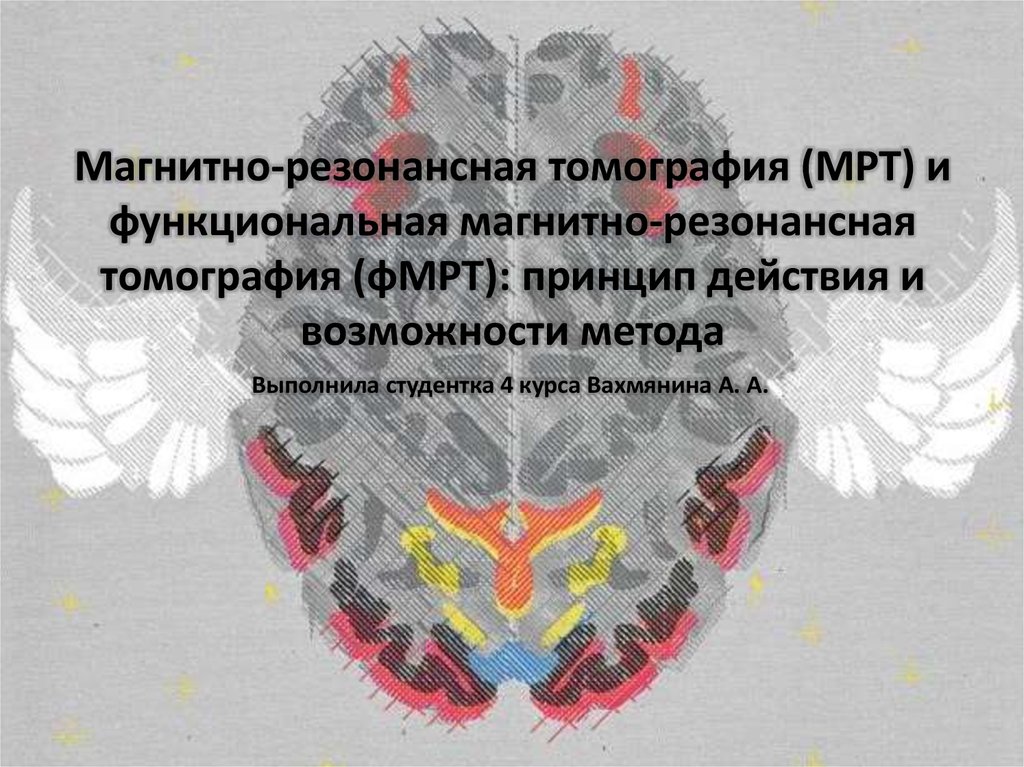 Функциональная мрт презентация