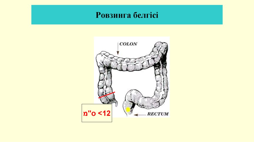 Ровзинга белгісі