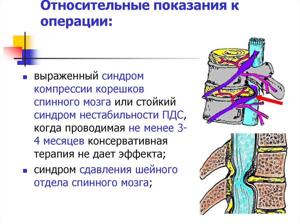 Спинальная нестабильность что это