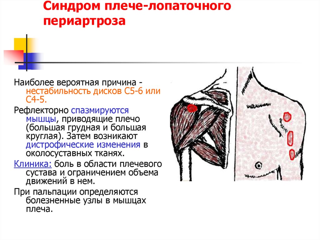 Дельтовидная мышца фото для вакцины плеча