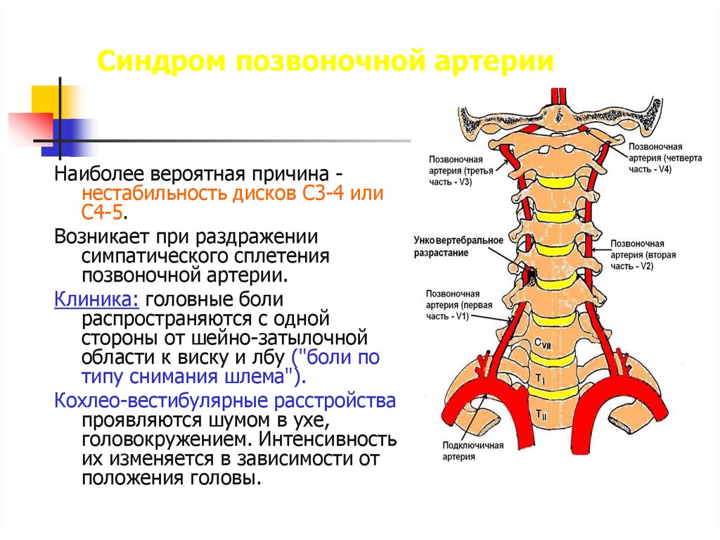 Позвоночные артерии картинки