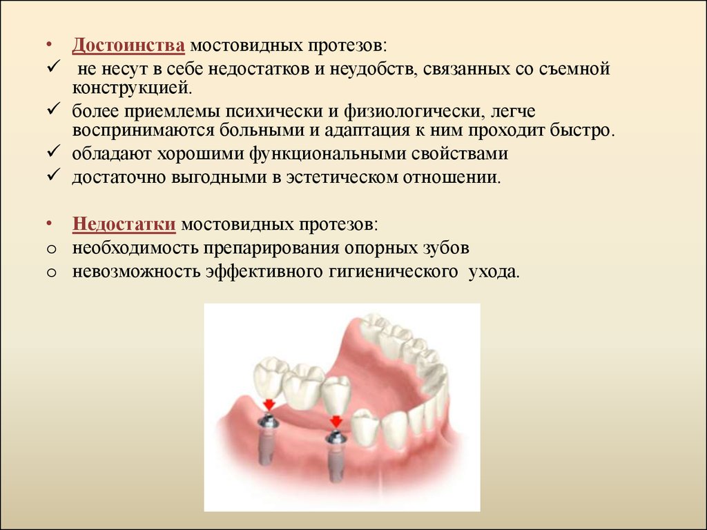 Съемные протезы презентация