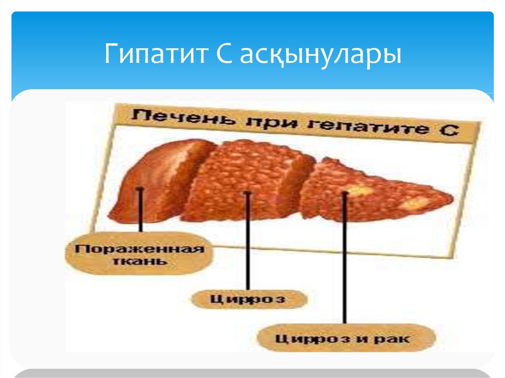 Бауыр барда бақытсызбын дей корме