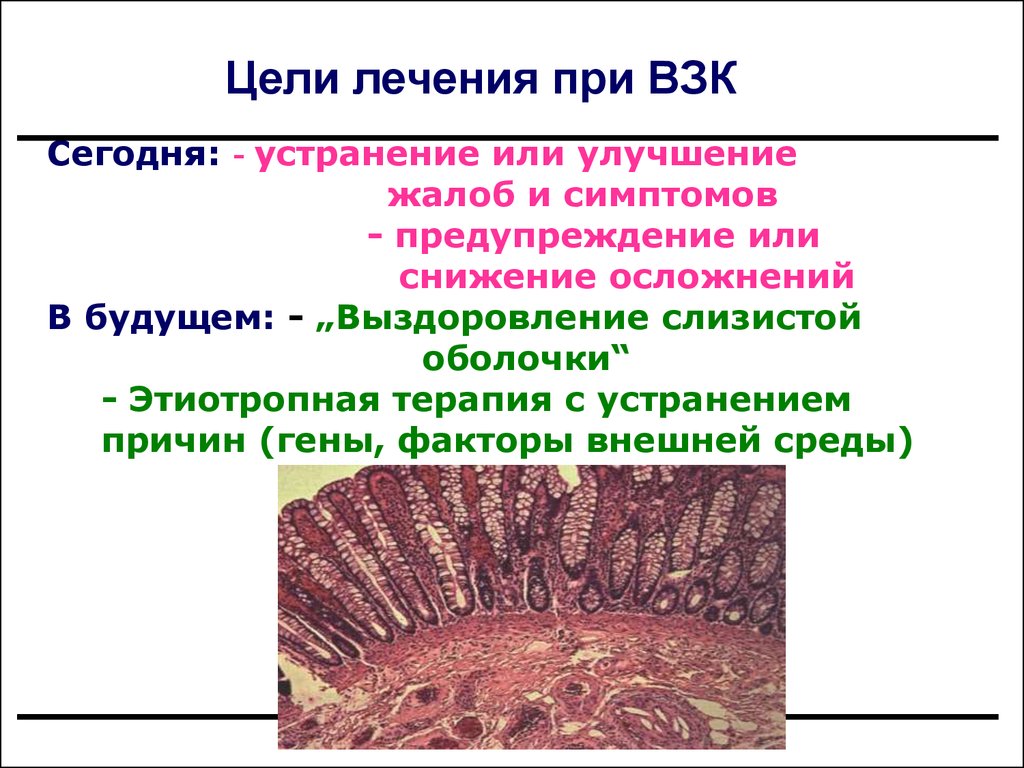 Взк кишечника. Воспалительные заболевания кишечника.