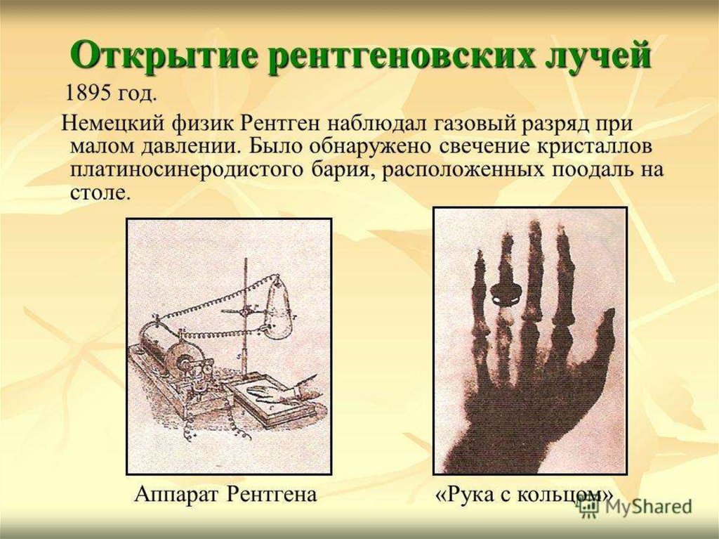 Информативность рентгеновского изображения