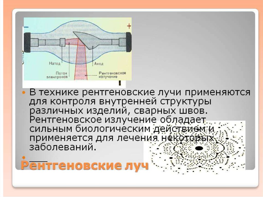 Обычно изображение получаемое при помощи рентгеновских лучей