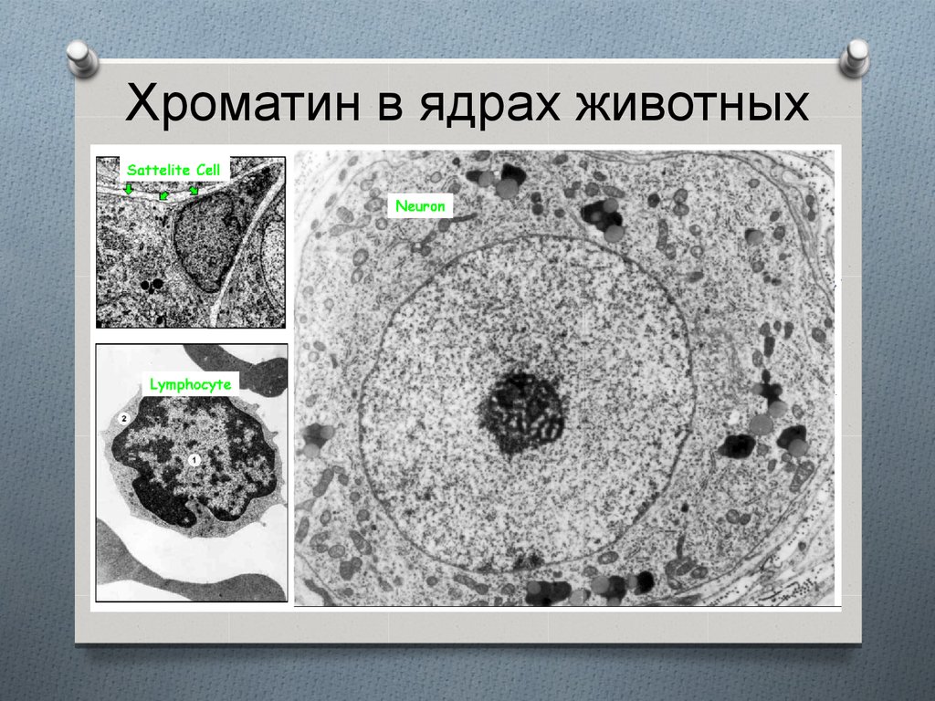 Хроматин. Хроматин в ядре. Хроматин картинки. Хроматин в ядре клетки.